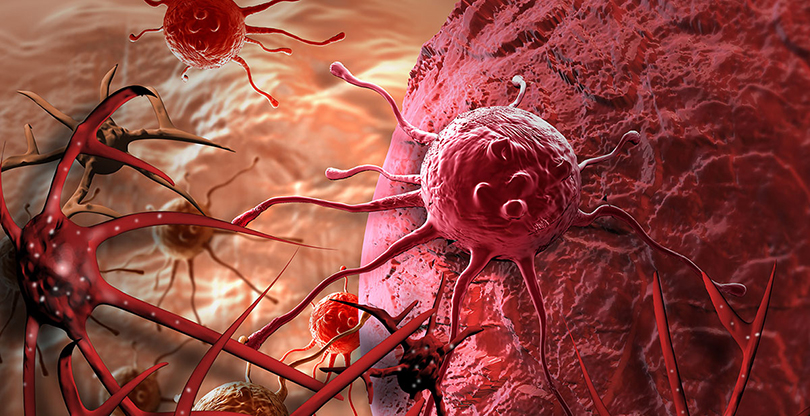 बाल क्यान्सर रोग विशेषज्ञ भन्दछन् : समयमा बिरामीलाई उपचार ल्याऔँ